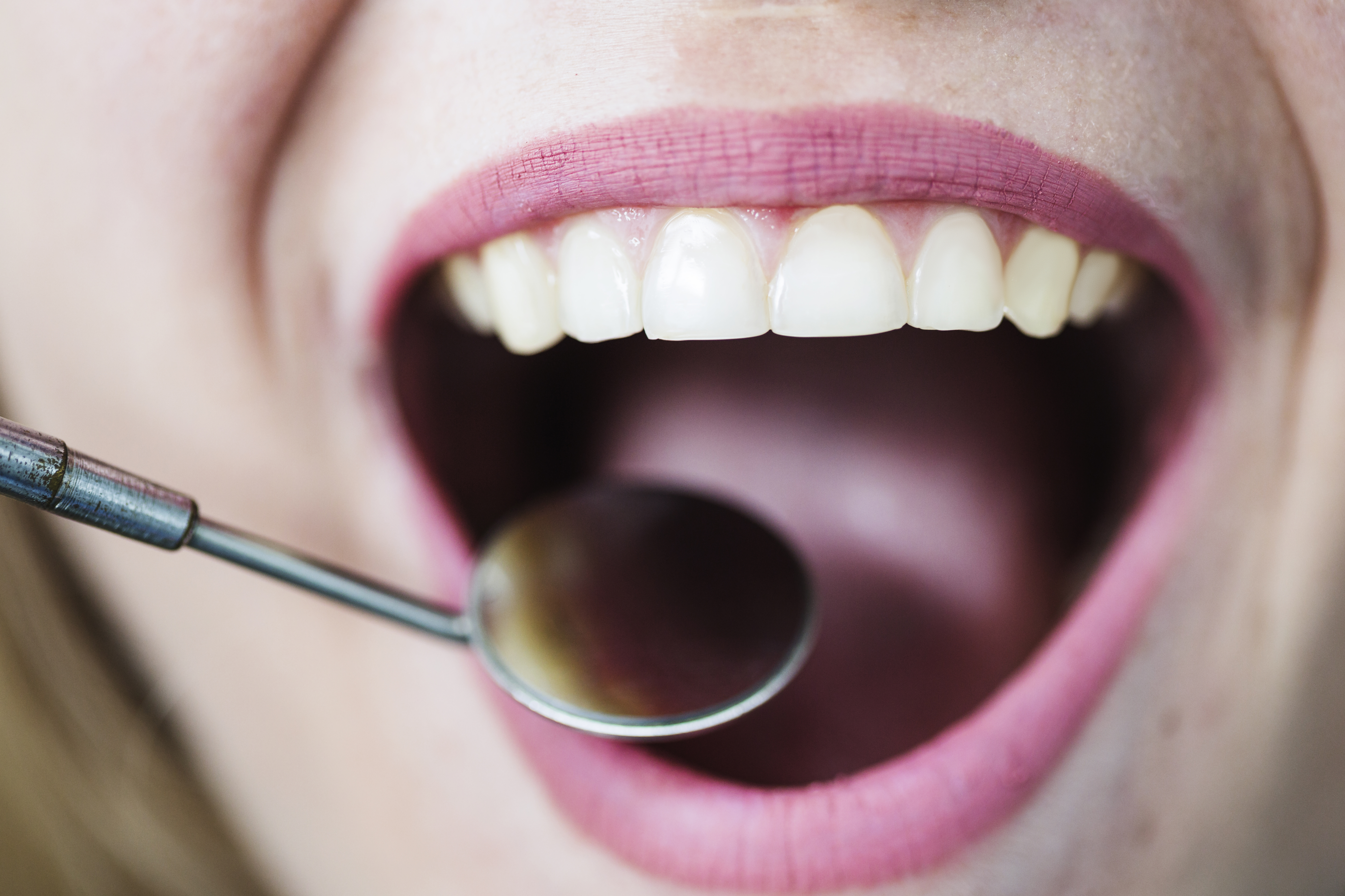 Specializzazione denti del giudizio